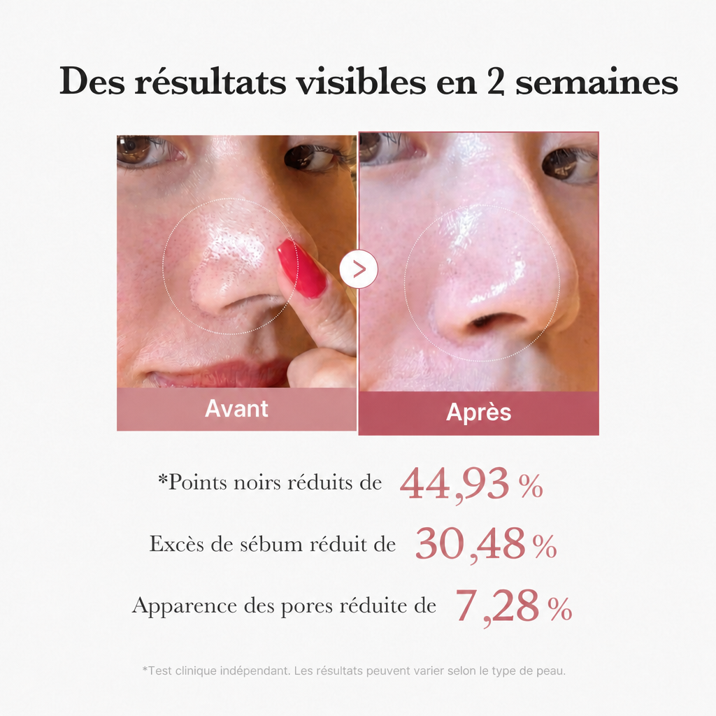 Pads Zéro Pores