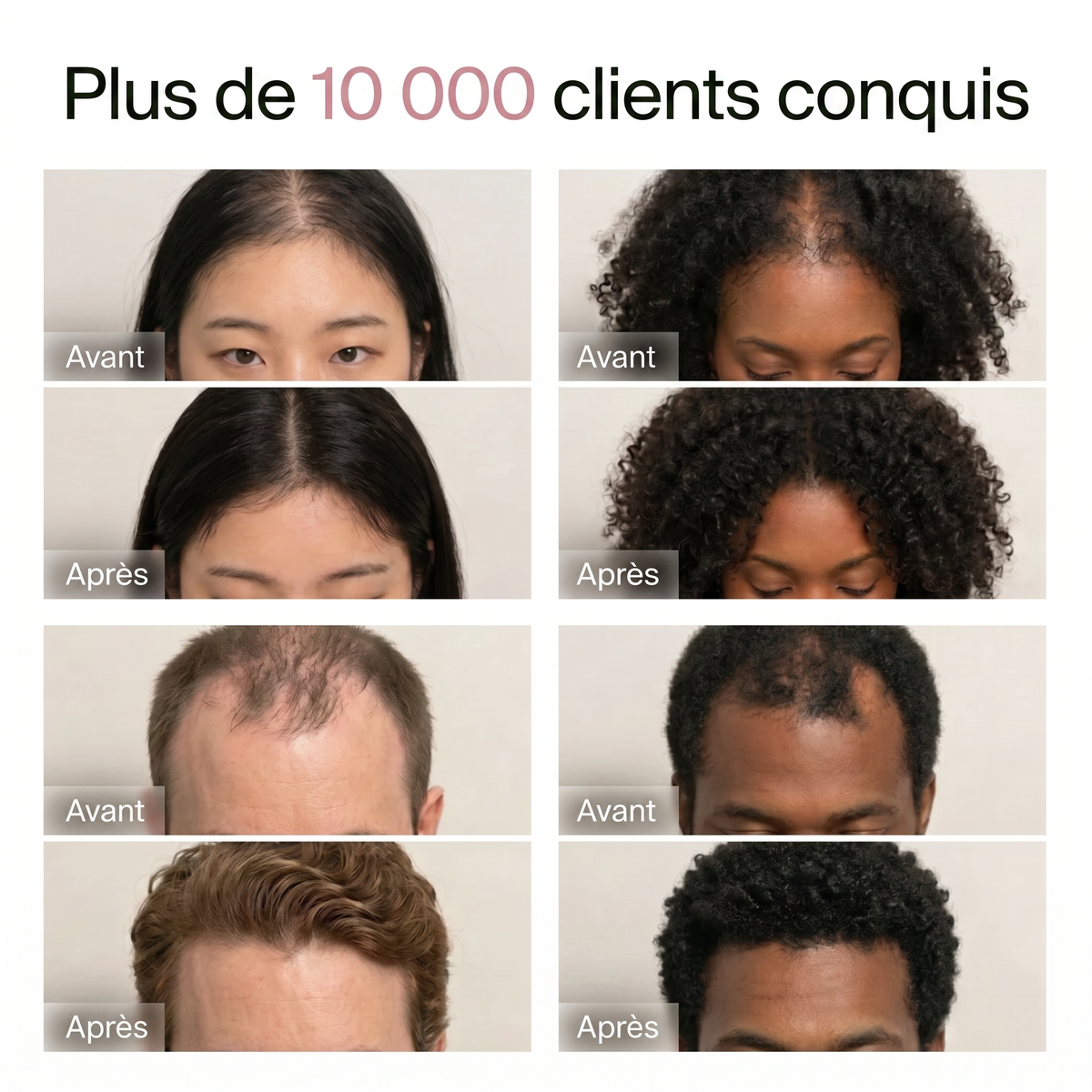 La Barre Coréenne Revitalisante — Cuir Chevelu