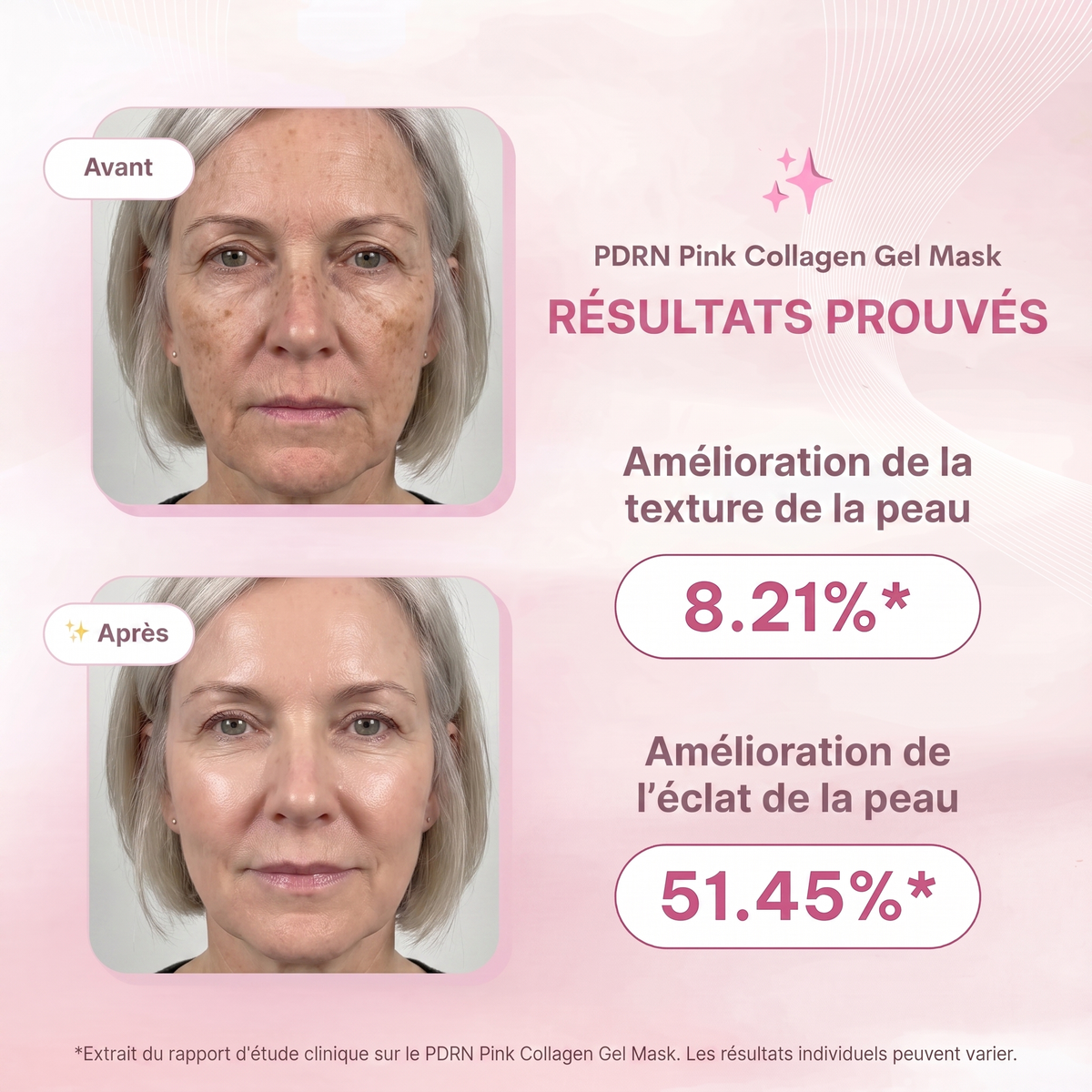 Masque Collagène & PDRN de Saumon