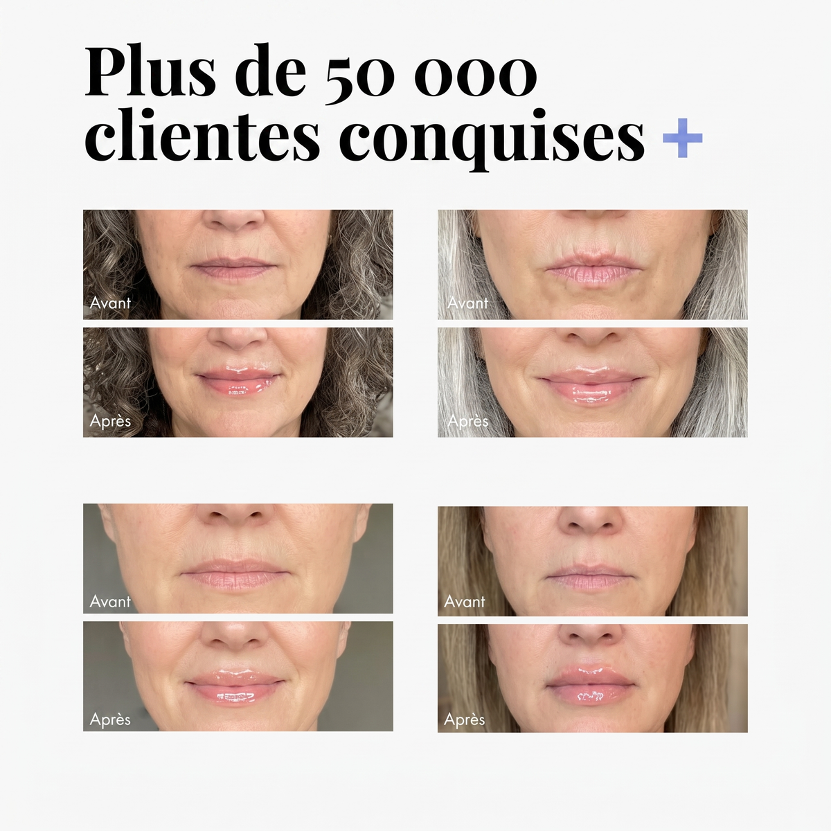Repulpeur de Lèvres Extrême